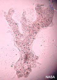 Image of amoeba