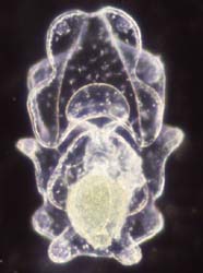 Image of auricularia (starfish larva)